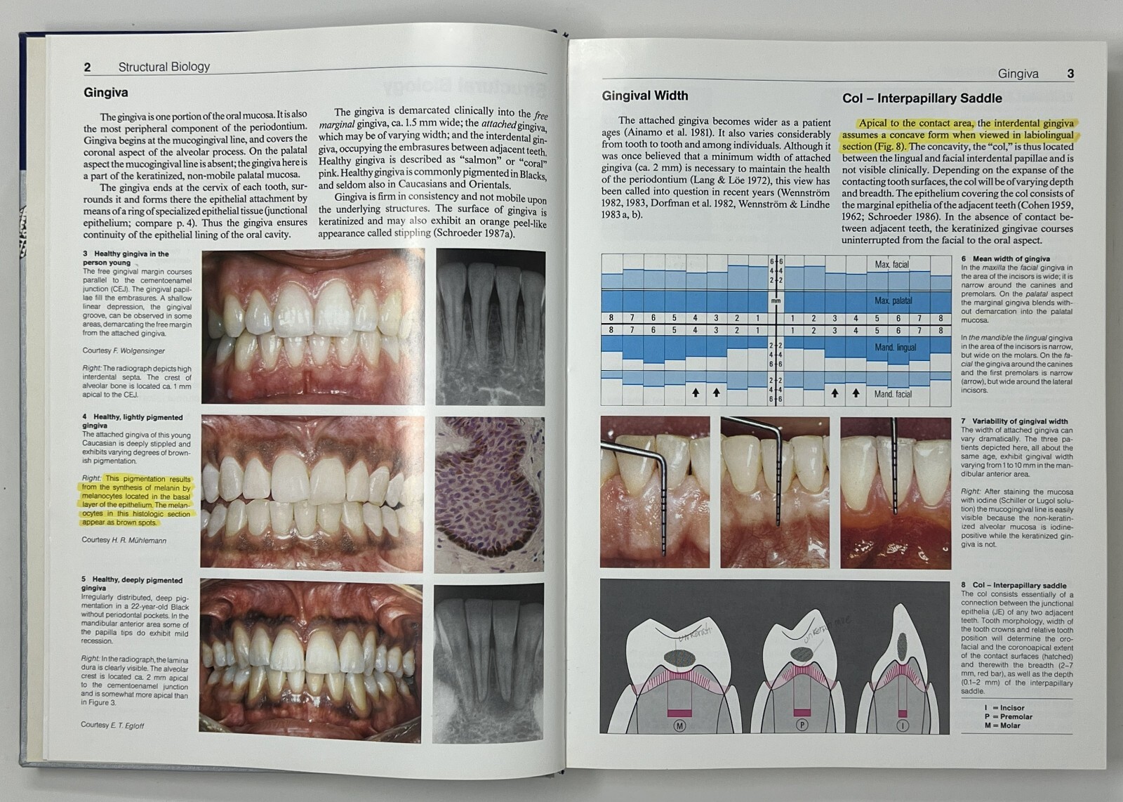 Color Atlas of Dental Medicine: Periodontology by Rateitschak, Wolf & Hassell HC